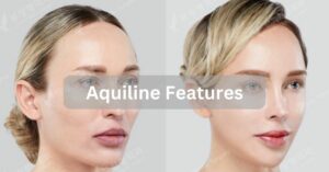 Aquiline Features